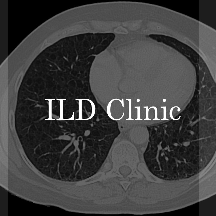 ILD and Sarooidosis Clinic – Interstitial Lung Disease Clinic